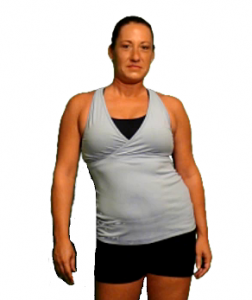 sciaticaposture Sciatica Shifted Posture